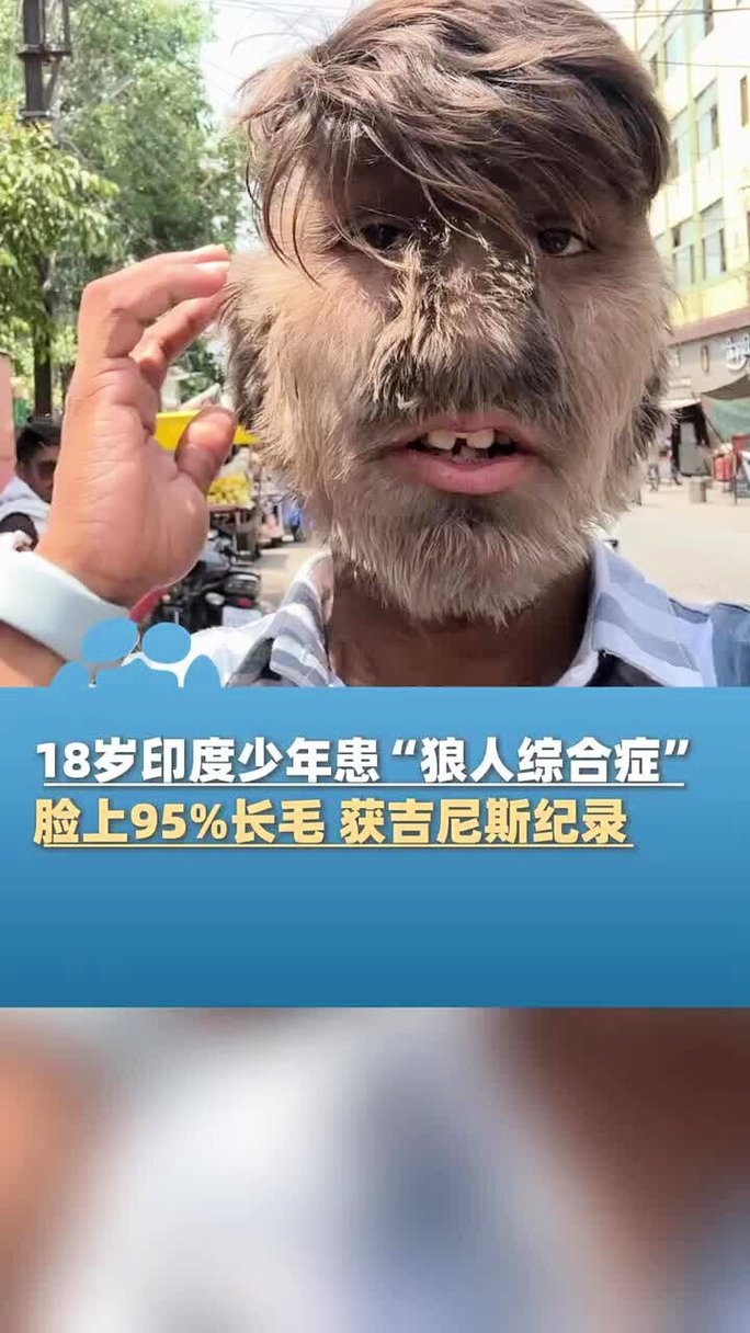 一边亲一边摸一边做爽免费的相关介绍